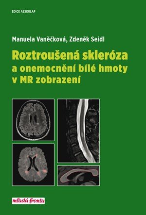 Manuela Vaněčková, Zdeněk Seidl: Roztroušená skleróza a onemocnění bílé hmoty v MR zobrazení Manuela Vaněčková, Zdeněk Seidl: Roztroušená skleróza a onemocnění bílé hmoty v MR zobrazení