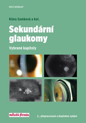 Klára Samková: Sekundární glaukomy Klára Samková: Sekundární glaukomy