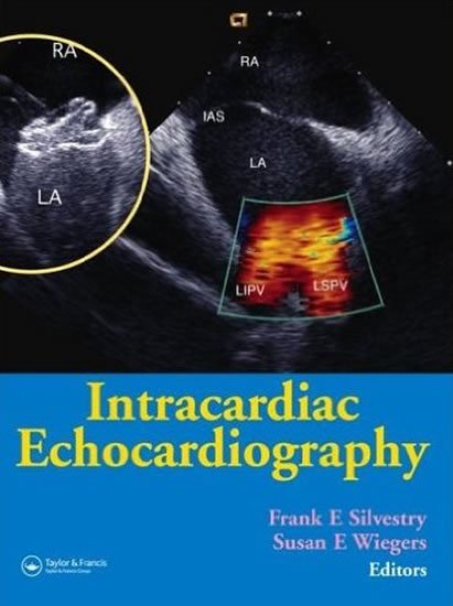 Silvestry Frank E.: Intracardiac Echocardiography Silvestry Frank E.: Intracardiac Echocardiography