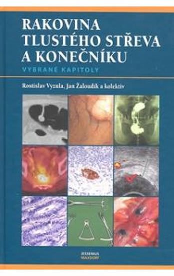Vyzula Rostislav, Žaloudík Jan a kolektiv: Rakovina tlustého střeva a konečníku - vybrané kapitoly Vyzula Rostislav, Žaloudík Jan a kolektiv: Rakovina tlustého střeva a konečníku - vybrané kapitoly