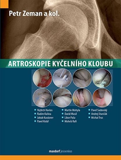 Zeman Petr: Artroskopie kyčelního kloubu
