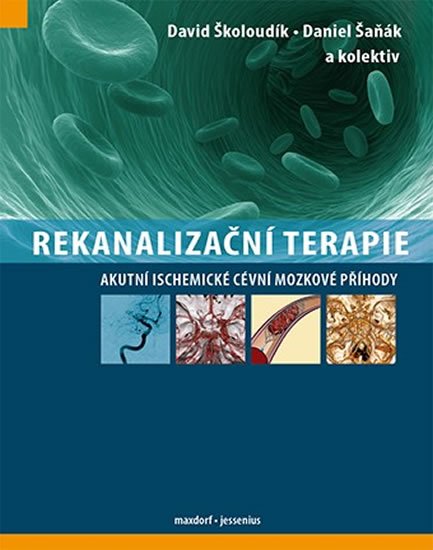 Školoudík a kolektiv David: Rekanalizační terapie - Akutní ischemické cévní mozkové příhody Školoudík a kolektiv David: Rekanalizační terapie - Akutní ischemické cévní mozkové příhody