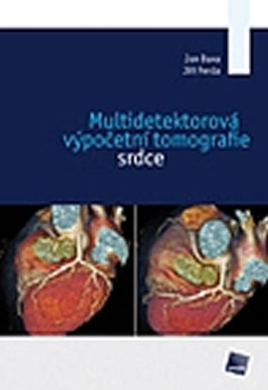 Baxa Jan: Multidetektorová výpočetní tomografie srdce