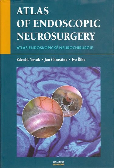 Novák Zdeněk, Říha Ivo, Chrastina Jan,: Atlas endoskopické neurochirurgie Novák Zdeněk, Říha Ivo, Chrastina Jan,: Atlas endoskopické neurochirurgie