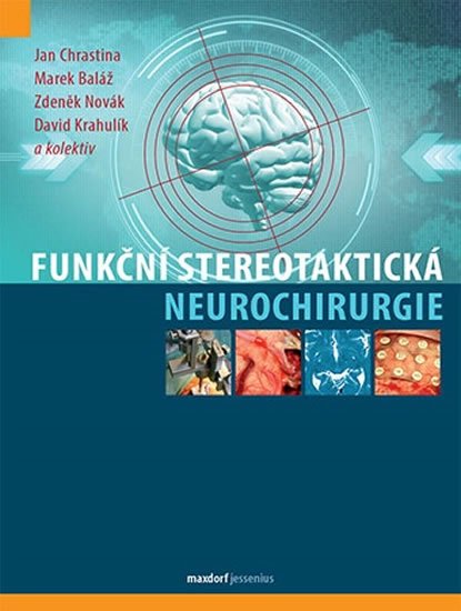 Chrastina Jan, Baláž Marek, Novák Zdeněk, Krahulík David,: Funkční stereotaktická neurochirurgie Chrastina Jan, Baláž Marek, Novák Zdeněk, Krahulík David,: Funkční stereotaktická neurochirurgie