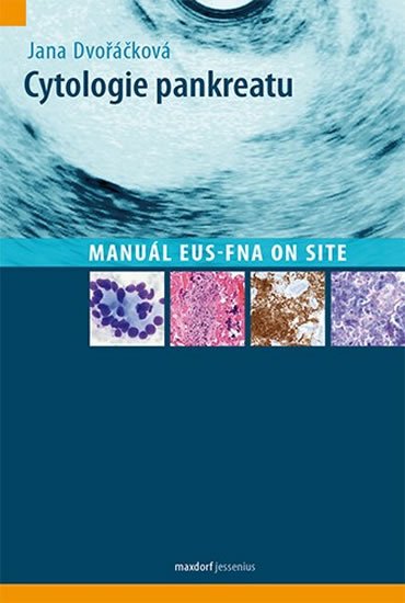 Dvořáčková Jana: Cytologie pankreatu - Manuál EUS-FNA on site Dvořáčková Jana: Cytologie pankreatu - Manuál EUS-FNA on site