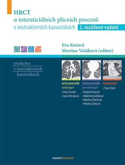 Koziar Vašáková Martina: HRCT u intersticiálních plicních procesů v instruktivních kazuistikách