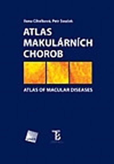 Cihelková Ilona: Atlas makulárních chorob