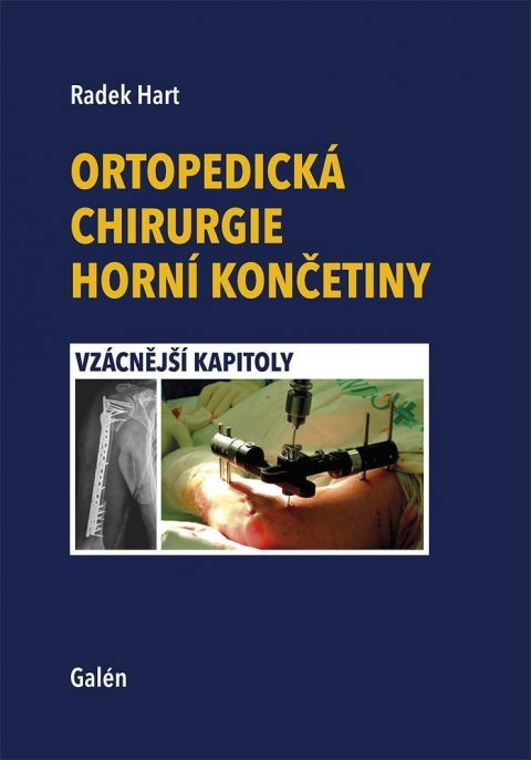 Hart Radek: Ortopedická chirurgie horní končetiny - Vzácnější kapitoly