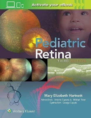 Hartnett Mary: Pediatric Retina