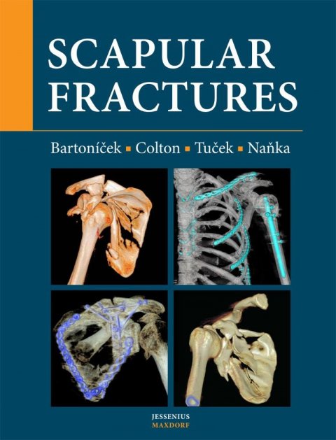 Naňka Ondřej: Scapular fractures