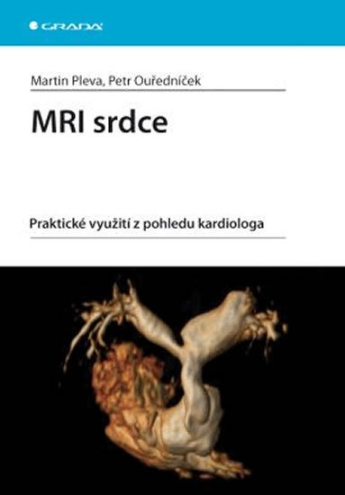 Pleva Martin, Ouředníček Petr: MRI srdce - praktické využití z pohledu