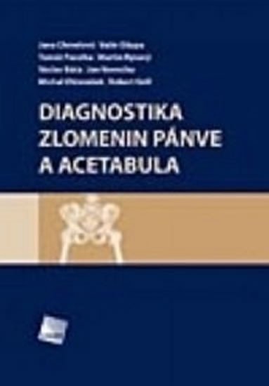 Vavrečka Jan: Diagnostika zlomenin pánve a acetabula