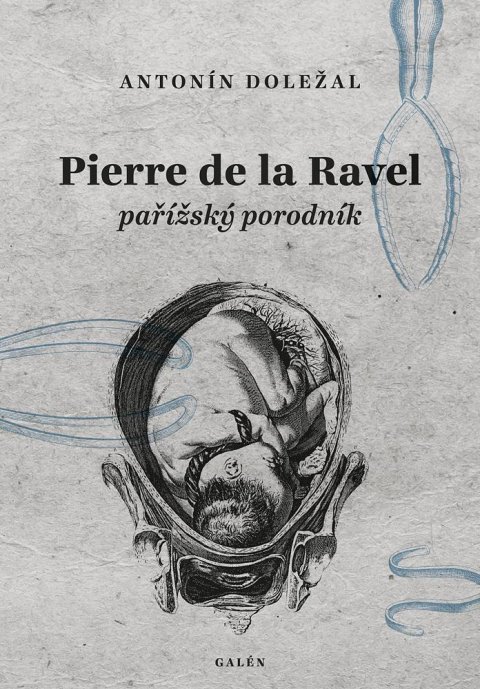 Doležal Antonín: Pierre de la Ravel, pařížský porodník