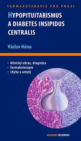 Hána Václav: Hypopituitarismus a diabetes insipidus centralis Hána Václav: Hypopituitarismus a diabetes insipidus centralis