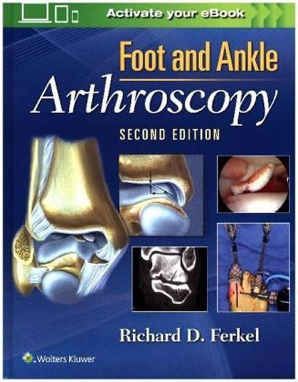 neuveden: Foot & Ankle Arthroscopy, 2nd Ed.
