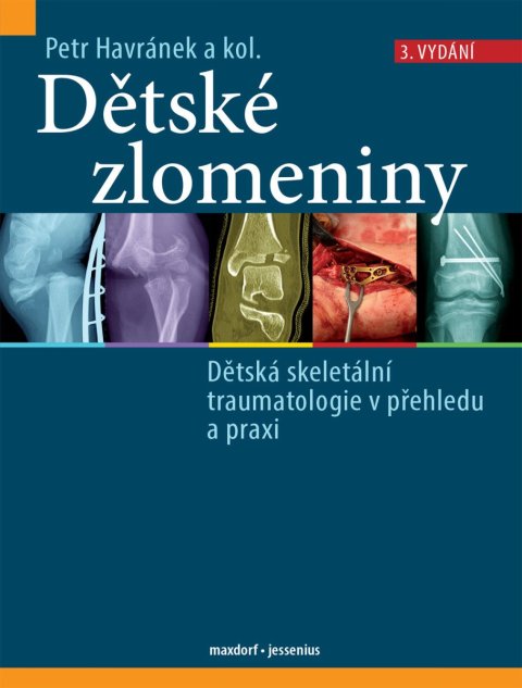 : Dětské zlomeniny - Dětská skeletální traumatologie v přehledu a praxi