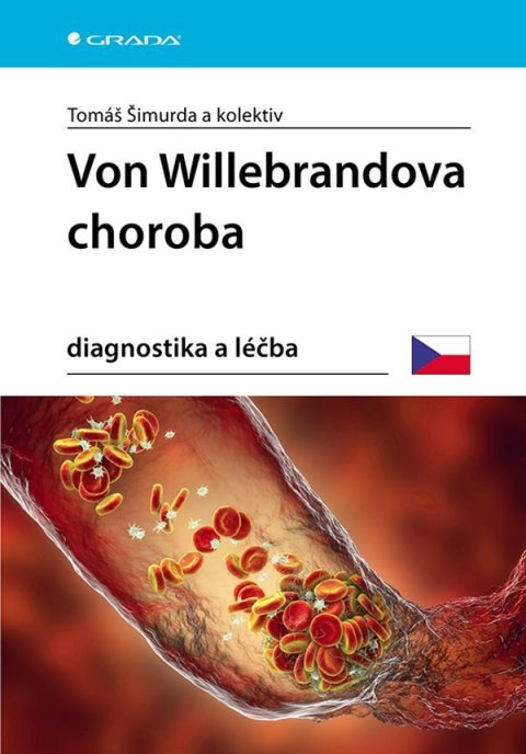 Šimurda Tomáš: Von Willebrandova choroba - Diagnostika a léčba