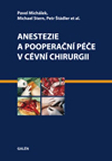 Michálek Pavel, Stern Michael, Štádler Petr: Anestezie a pooperační péče v cévní chirurgii Michálek Pavel, Stern Michael, Štádler Petr: Anestezie a pooperační péče v cévní chirurgii