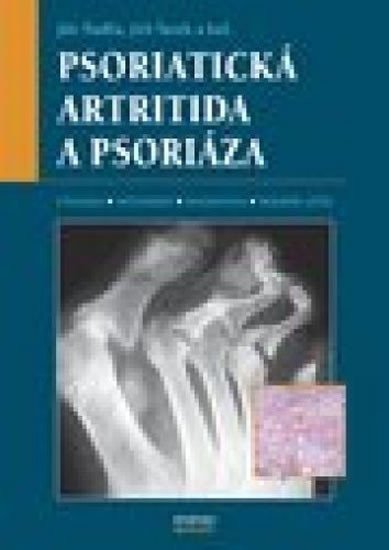 Štork Jiří: Psoriatická artritida a psoriáza