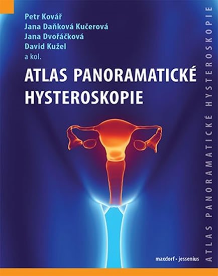 kolektiv autorů: Atlas panoramatické hysteroskopie kolektiv autorů: Atlas panoramatické hysteroskopie