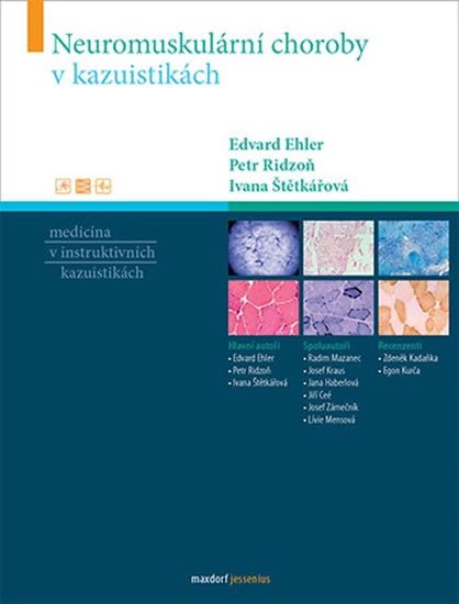 Štětkářová Ivana: Neuromuskulární choroby v kazuistikách