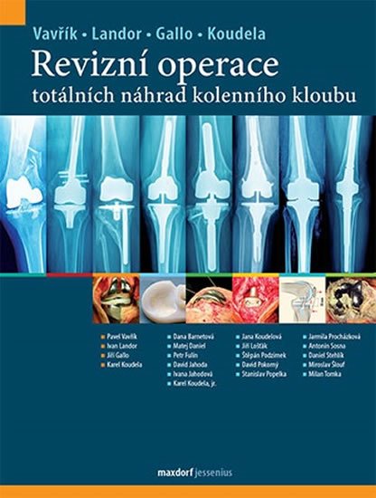 Vavřík Pavel: Revizní operace totálních náhrad kolenního kloubu
