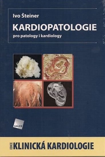 Šteiner Ivo: Kardiopatologie
