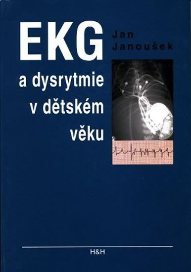 Janoušek Jan: EKG a dysrytmie v dětském věku (Praktický návod k diagnostice a léčbě)