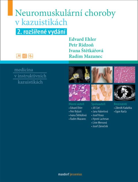 Štětkářová Ivana: Neuromuskulární choroby v kazuistikách