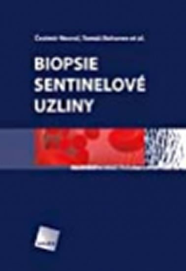 Macho Adrián: Biopsie sentinelové uzliny