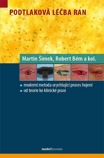 Šimek Martin, Bém Robert,: Podtlaková léčba ran Šimek Martin, Bém Robert,: Podtlaková léčba ran
