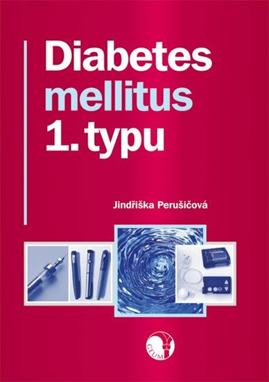Perušičová Jindřiška: Diabetes mellitus 1. typu Perušičová Jindřiška: Diabetes mellitus 1. typu