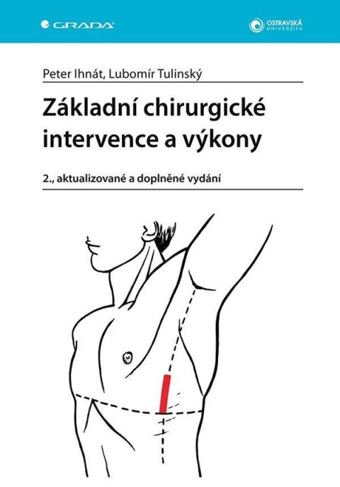 Ihnát Peter: Základní chirurgické intervence a výkony