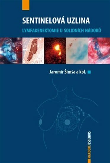 Šimša Jaromír a kolektiv: Sentinelová uzlina Šimša Jaromír a kolektiv: Sentinelová uzlina