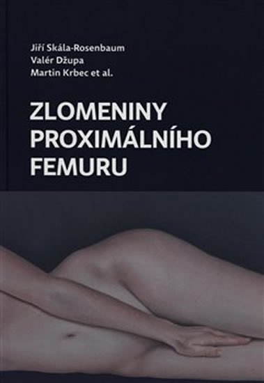 Skála Rosenbaum Jiří, Džupa Valér, Krbec Martin,: Zlomeniny proximálního femuru Skála Rosenbaum Jiří, Džupa Valér, Krbec Martin,: Zlomeniny proximálního femuru