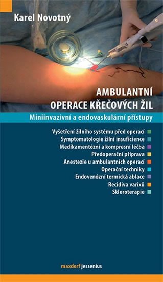 Novotný Karel: Ambulantní operace křečových žil Novotný Karel: Ambulantní operace křečových žil