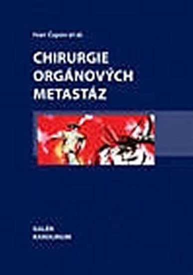 Čapov Ivan: Chirurgie orgánových metastáz