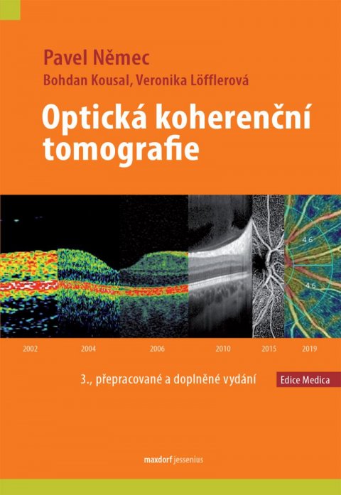 Němec Pavel: Optická koherenční tomografie Němec Pavel: Optická koherenční tomografie
