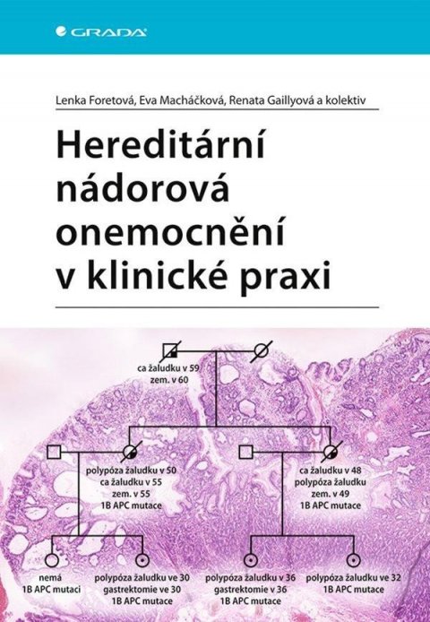 Foretová Lenka: Hereditární nádorová onemocnění v klinické praxi Foretová Lenka: Hereditární nádorová onemocnění v klinické praxi