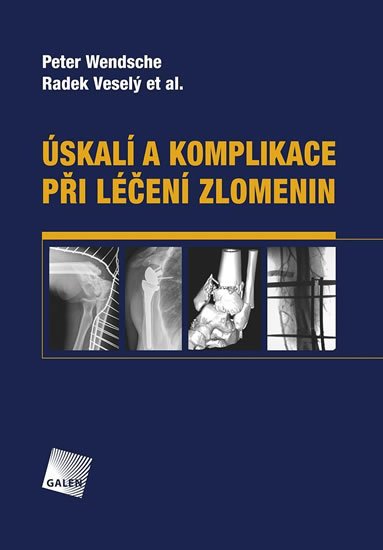 Wendsche Peter: Úskalí a komplikace při léčení zlomenin