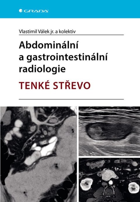 Válek Vlastimil: Abdominální a gastrointestinální radiologie - Tenké střevo