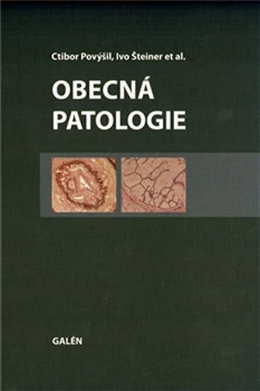 Povýšil Ctibor: Obecná patologie