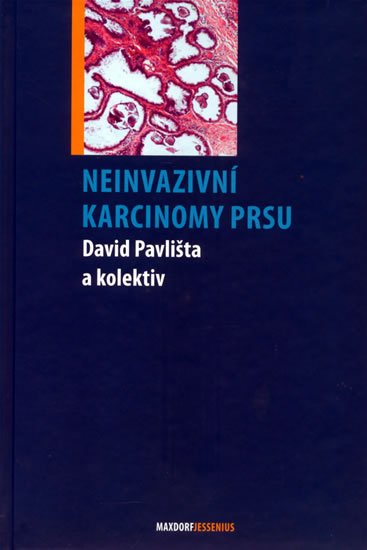 kolektiv autorů: Neinvazivní karcinomy prsu