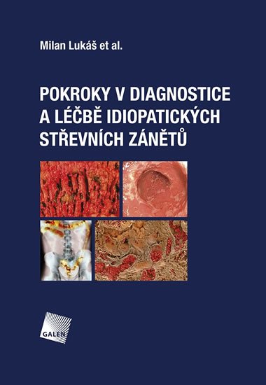 Lukáš Milan: Pokroky v diagnostice a léčbě idiopatických střevních zánětů