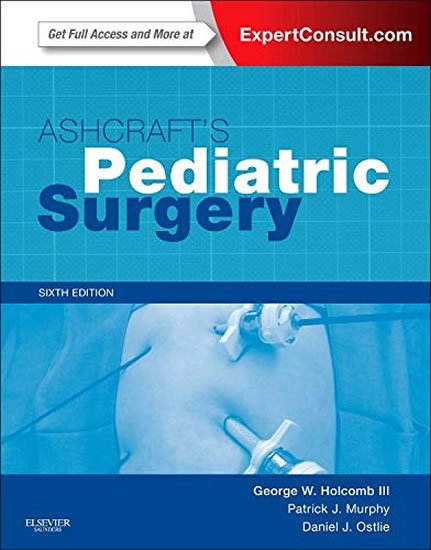 Holcombe Dominic James: Ashcraft´s Pediatric Surgery: Expert Consult - Online + Print, 6e (Expert C