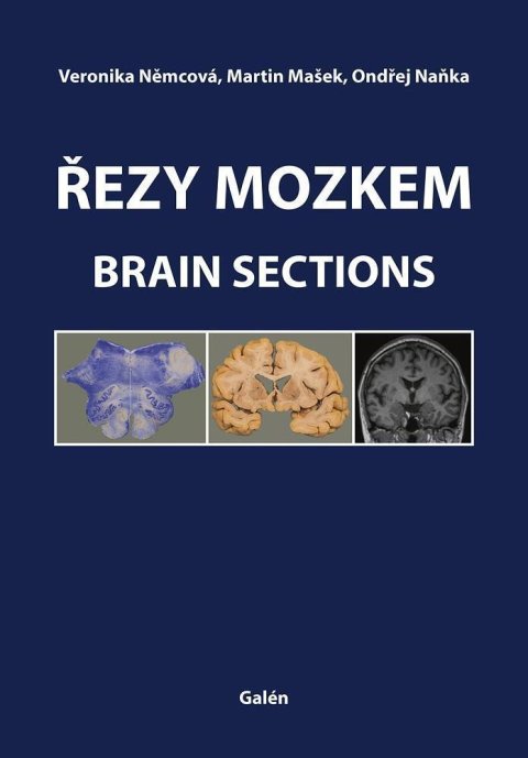 Naňka Ondřej: Řezy mozkem / Brain Sections