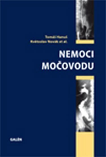 Novák Květoslav: Nemoci močovodu