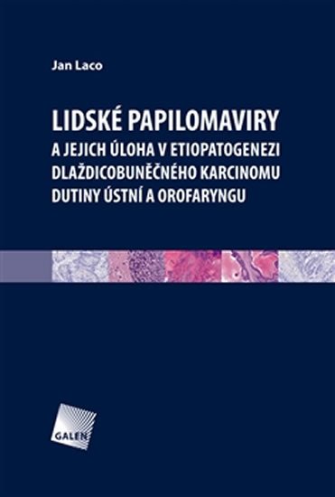 Laco Jan: Lidské papilomaviry Laco Jan: Lidské papilomaviry