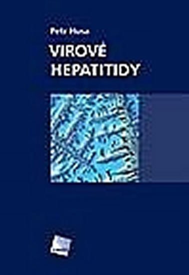 Husa Petr: Virové hepatitidy
